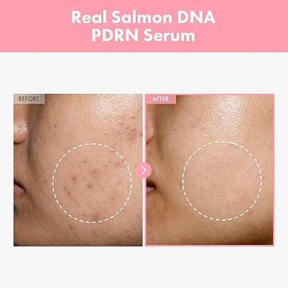 Nicotinamide Moisturizing The Lifting Face Serum Deep Hydrating And Firming Brightening Skin Color Lock Moisture Relieve Dry Fading Spots