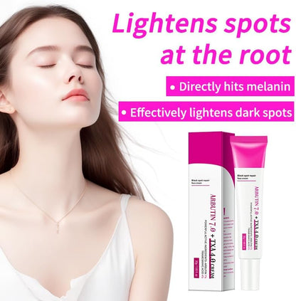Arbutin 7% + Tranexamic Acid 4% Cream, Dark Spot Corrector Face Cream for Women Dark Spots,Freckle, Blemishes,Pigmentation,for Uneven Skin Tone