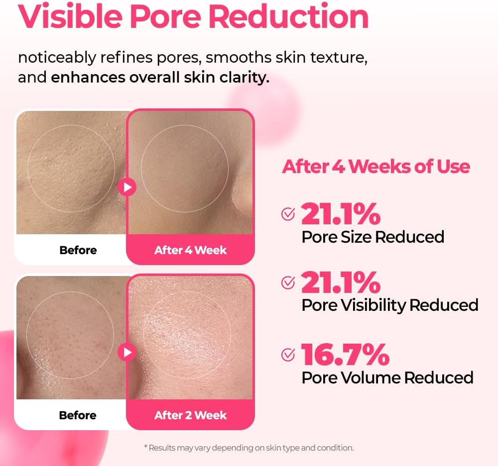 Dr.Melaxin Cemenrete Cyano Pink Spicule Serum – Calcium Pore Tightening & Skin Regeneration Serum with Vitamin B12, Micro-Spicule for Absorption, Smooth Texture & Glow – Korean Skincare (1.01 Fl Oz)