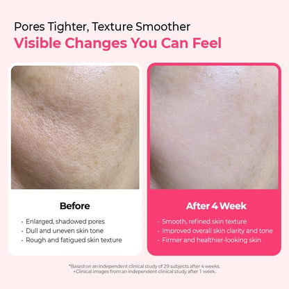 Dr.Melaxin Cemenrete Cyano Pink Spicule Serum – Calcium Pore Tightening & Skin Regeneration Serum with Vitamin B12, Micro-Spicule for Absorption, Smooth Texture & Glow – Korean Skincare (1.01 Fl Oz)