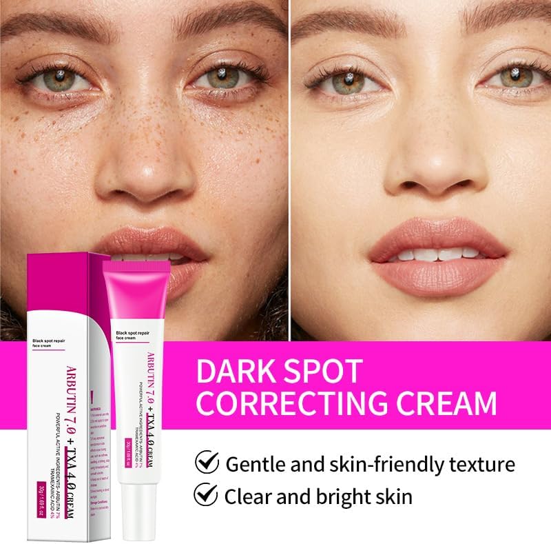 Arbutin 7% + Tranexamic Acid 4% Cream, Dark Spot Corrector Face Cream for Women Dark Spots,Freckle, Blemishes,Pigmentation,for Uneven Skin Tone
