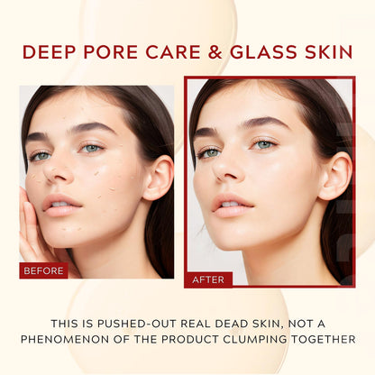 Pink Spicule Serum + Picotonic Shot Ampoule + Peel Shot Exfoliant Rice Ampoule, Rice Exfoliator for Face Pore Refining, Picotonic Glow Serum for Pigmentation & Dark Spot, Glass Skin, 3PCS