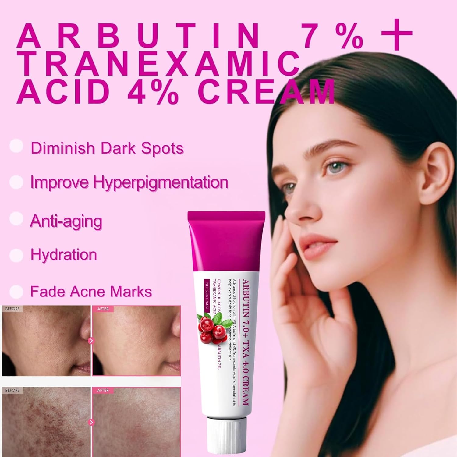 2PCS Arbutin 7% + Tranexamic Acid 4% Cream, Dark Spot Remover for Face Hyperpigmentation, Reduces Freckles & Blemishes,Even Skin Tone, Brightening Moisturiser with Glutathione & Niacinamide
