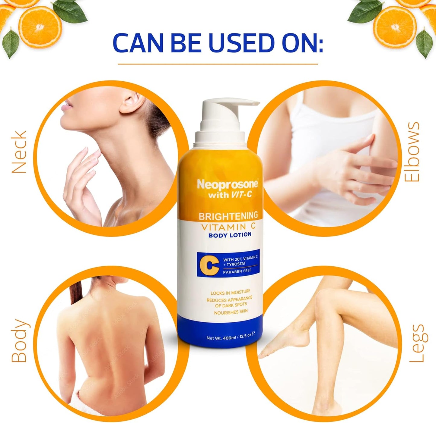NEOPROSONE Brightening Body Lotion 400ml - Formulated to Fade Dark Spots on Elbows, Knees, Neck, Body and Intimate Parts, with Lactic Acid, Alpha Arbutin Complex and Vitamin C