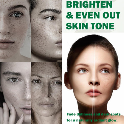 Niacinamide Dark Spot Care Glow Serum – Brightening Face Serum for Dullness & Uneven Skin Tone, with Intense Hydration, 50ml
