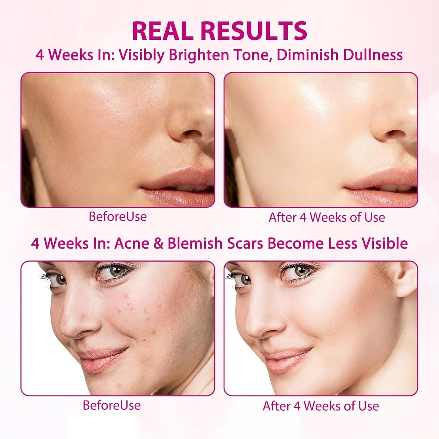 Arbutin 7% + Tranexamic Acid 4% Cream,Arbutin 7.0 Txa 4.0 Cream,Even Skin Tone, Fading Marks,Moisturiser, Gentle Skincare (50 ml)