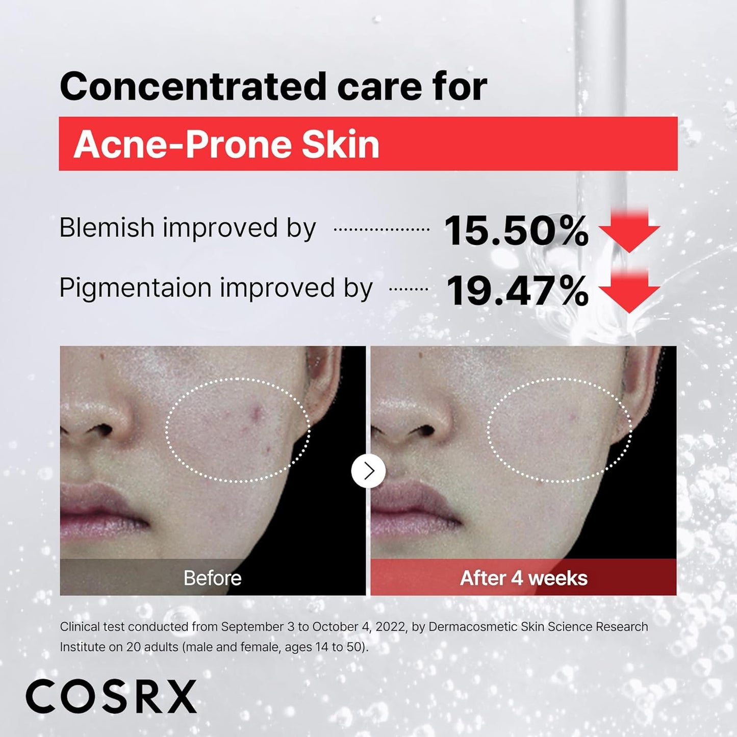 COSRX Niacinamide 15% Face Serum, Minimizing Pores & Sebums, Blemish Treatments for Discoloration, Dark Spots, Enlarged Pores, Anti-aging, 0.67 fl.oz / 20 ml, Animal Testing-Free