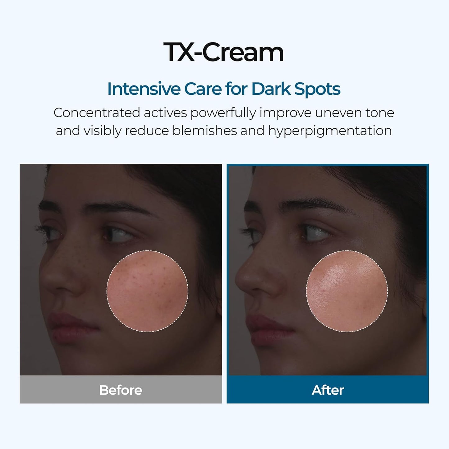 Dr.Melaxin Tx Tranexamic Acid Cream Skin Freckle Cream, Blemishes, Anti-Pigmetation Korean Skin Care Korean Cosmetics 1.69 Fl Oz (50ml) White