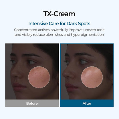 Dr.Melaxin Tx Tranexamic Acid Cream Skin Freckle Cream, Blemishes, Anti-Pigmetation Korean Skin Care Korean Cosmetics 1.69 Fl Oz (50ml) White