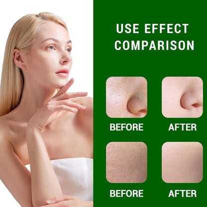 Dark Spot Correcting Glow Serum, Dark Spot Remover for Face Pore Refining, Fades Acne Marks Pits