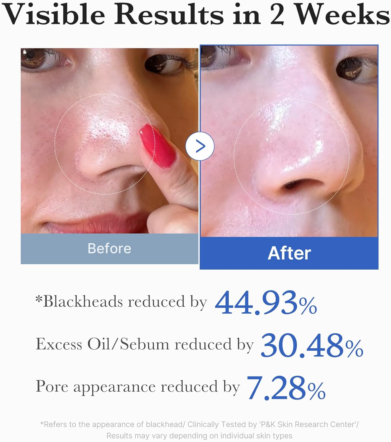 medicube Intensive Pore Care Duo: medicube Zero Pore Pads 2.0 and Zero Exosome Shot 7,500 PPM Spicule Facial Serum