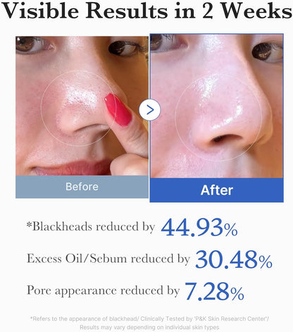 medicube Intensive Pore Care Duo: medicube Zero Pore Pads 2.0 and Zero Exosome Shot 7,500 PPM Spicule Facial Serum