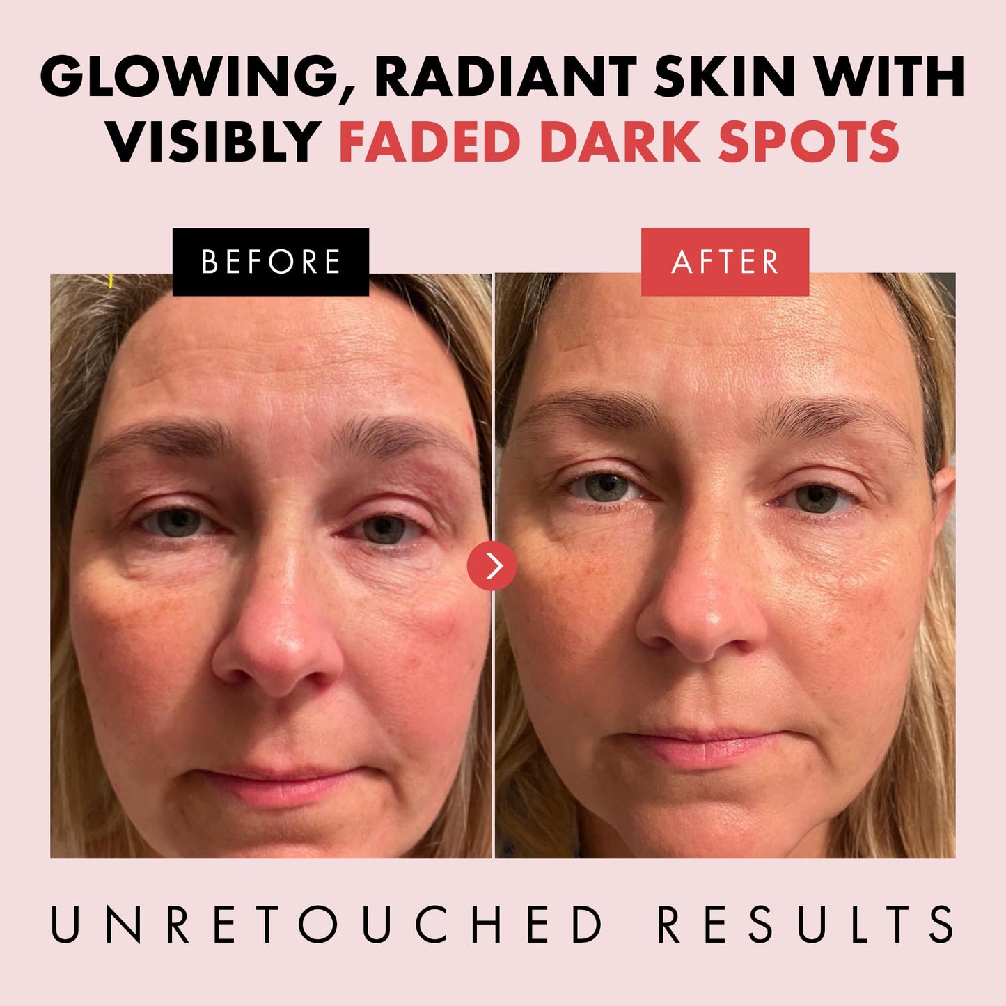 Eclat Skincare Glow Up Vitamin C Serum - Vitamin C Serum for Face with Hyaluronic Acid, Ferulic Acid & Vit E - Skin Brightening Face Care - Anti Aging, Hydrating & Dark Spot Lightening 30ml