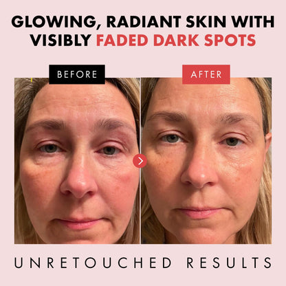 Eclat Skincare Glow Up Vitamin C Serum - Vitamin C Serum for Face with Hyaluronic Acid, Ferulic Acid & Vit E - Skin Brightening Face Care - Anti Aging, Hydrating & Dark Spot Lightening 30ml