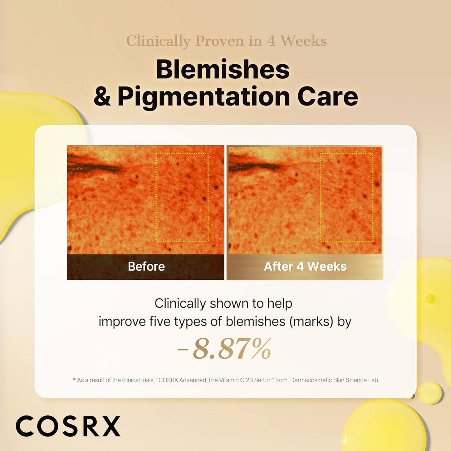 COSRX Advanced Pure Vitamin C 23 Serum 20 ml (Renewal Edition) Korean Vitamin C Serum with Vitamin E & Glutathione for Fine Lines, Uneven Skin Tone & Dull Skin, Korean Skin Care