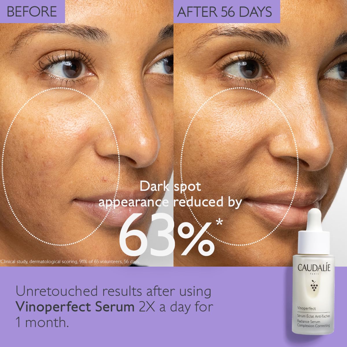 Caudalie Vinoperfect Brightening Dark Spot Serum Vitamin C Alternative - 62x More Effective than Vitamin C with Viniferine and Niacinamide for a Visibly Brighter Even Complexion - 30ml