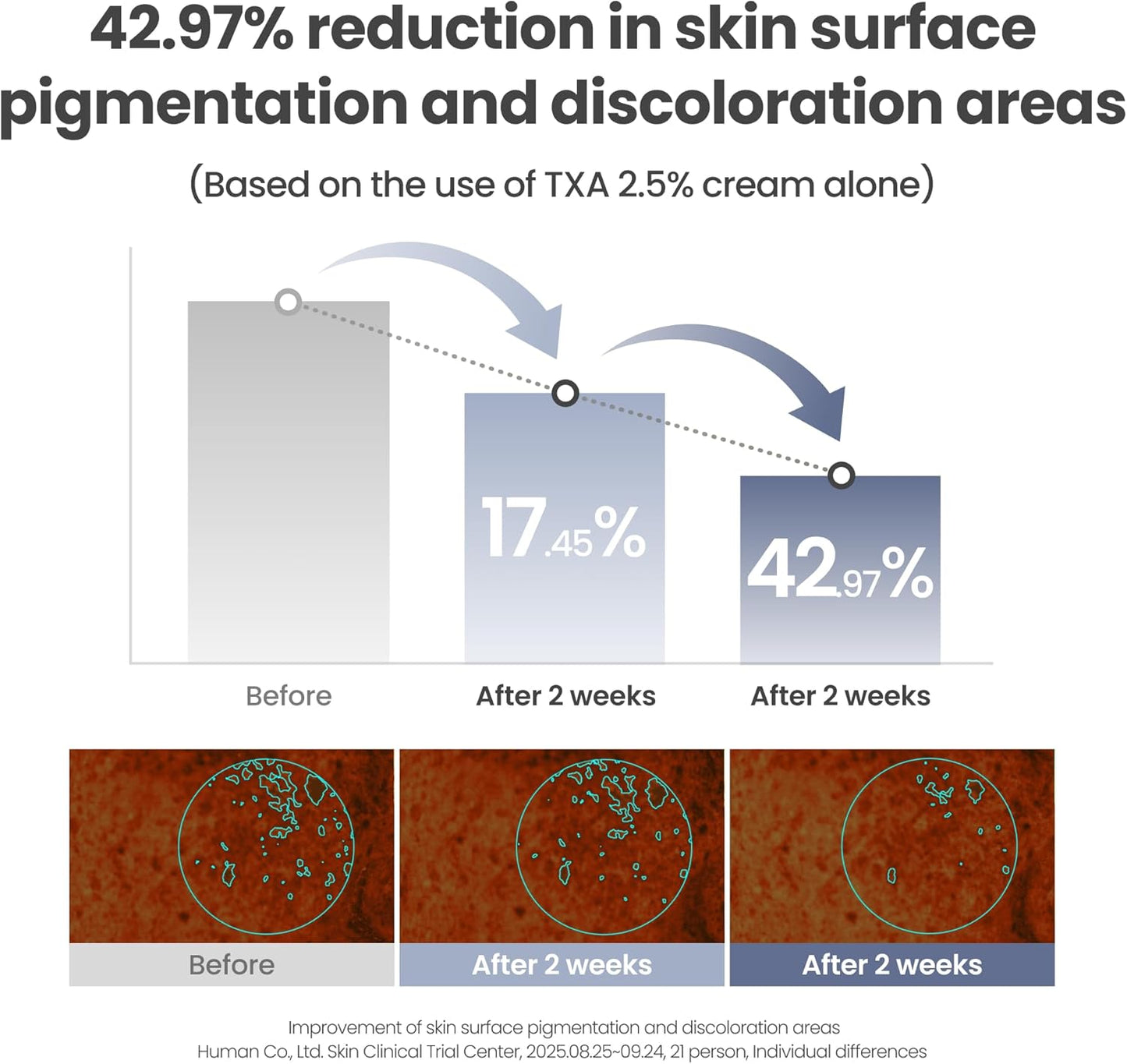 AXIS-Y TXA 2.5% Intensive Brightening Cream - Tranexamic Acid, Niacinamide & Glutathione for Hyperpigmentation & Dark Spot Corrector - Vegan Korean Skin Care Moisturizer Face Cream - 50ml/1.69 fl. oz.
