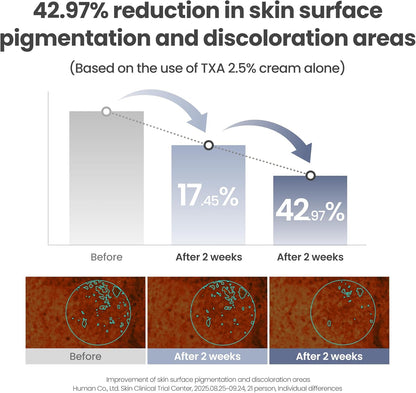 AXIS-Y TXA 2.5% Intensive Brightening Cream - Tranexamic Acid, Niacinamide & Glutathione for Hyperpigmentation & Dark Spot Corrector - Vegan Korean Skin Care Moisturizer Face Cream - 50ml/1.69 fl. oz.