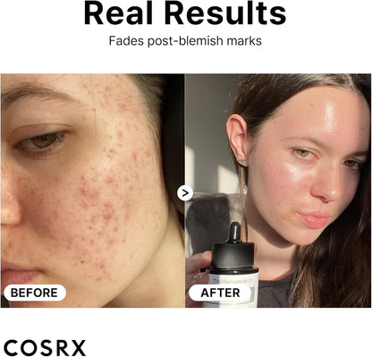 COSRX Niacinamide 15% Face Serum, Minimizing Pores & Sebums, Blemish Treatments for Discoloration, Dark Spots, Enlarged Pores, Anti-aging, 0.67 fl.oz / 20 ml, Animal Testing-Free