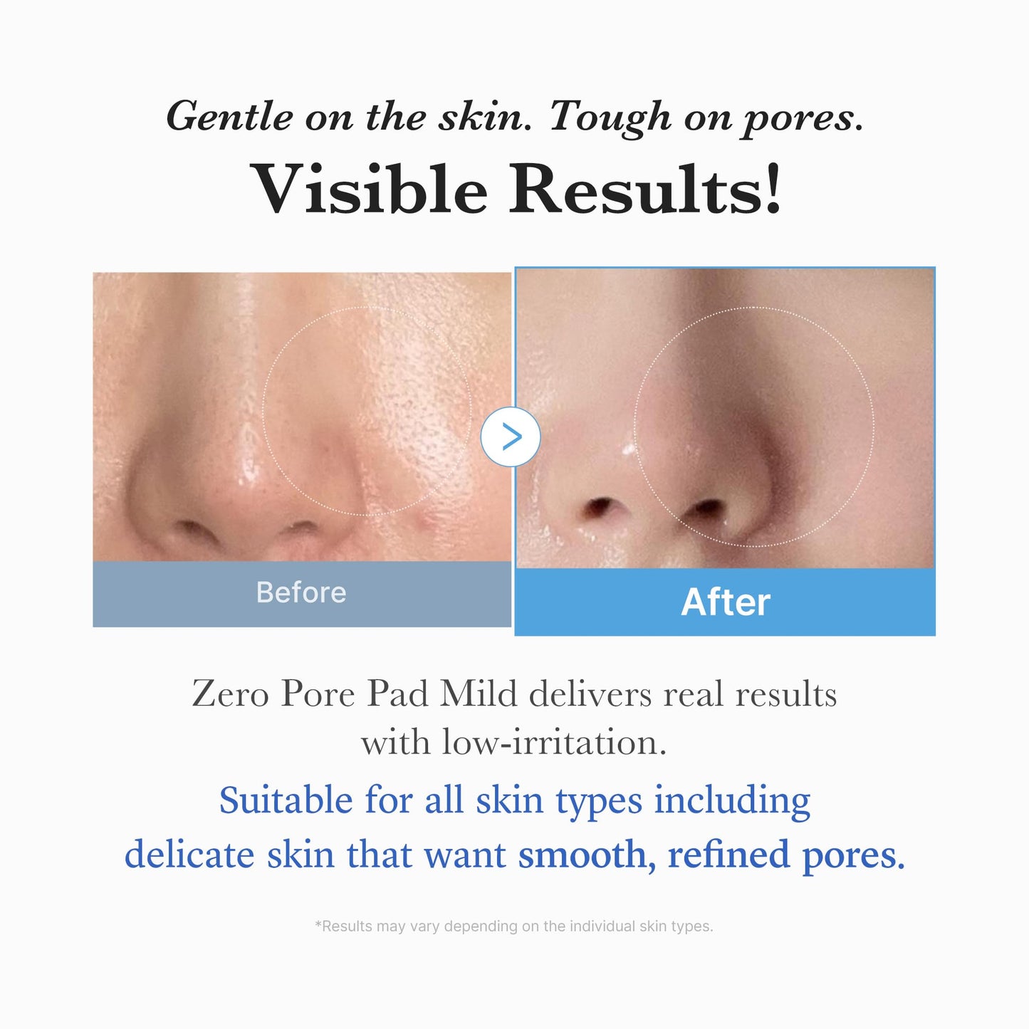 medicube Zero Pore Pads 2.0, Dual-Textured Facial Toner Pads for Exfoliation and Pore Care with 4.5% AHA Lactic Acid & 0.45% BHA Salicylic Acid, Ideal for All Skin Types, Korean Skin Care (70 units)