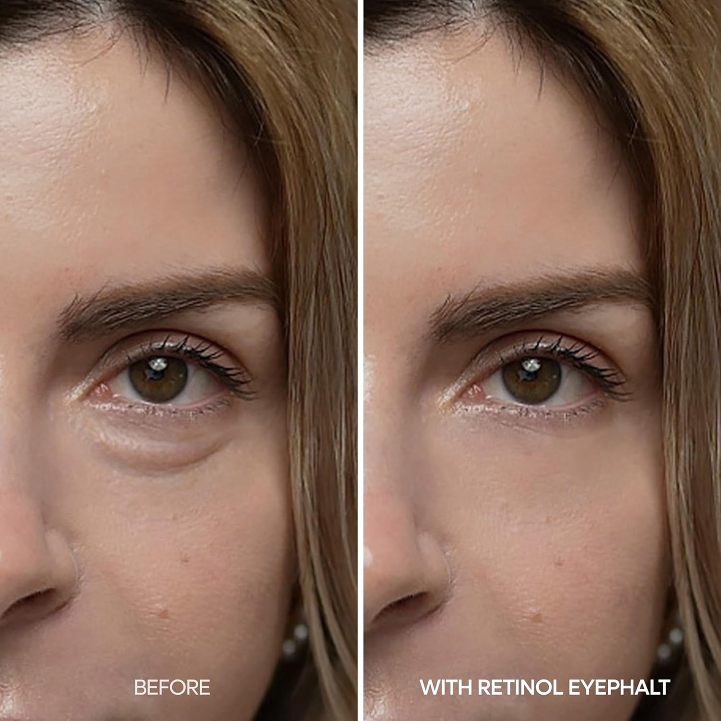 Dr.Melaxin Retinol Eyebag Cream For Puffiness, Wrinkle, Eye Moisturizer With Niacinamide & Ceramide Makeup Friendly Korean Skin Care 0.35 fl oz (Pack of 1)
