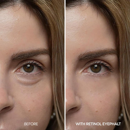 Dr.Melaxin Retinol Eyebag Cream For Puffiness, Wrinkle, Eye Moisturizer With Niacinamide & Ceramide Makeup Friendly Korean Skin Care 0.35 fl oz (Pack of 1)