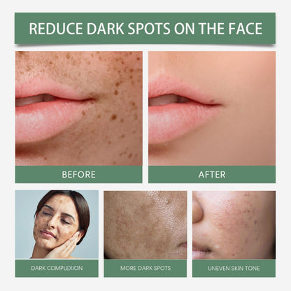 Activated Dark Spot Glow Serum - 6+1+1 Formula with Niacinamide for Brightening and Hydrating Face, Lightweight Korean Skincare Serum Targeting Uneven Tone, 50ml / 1.69 fl. oz Tube