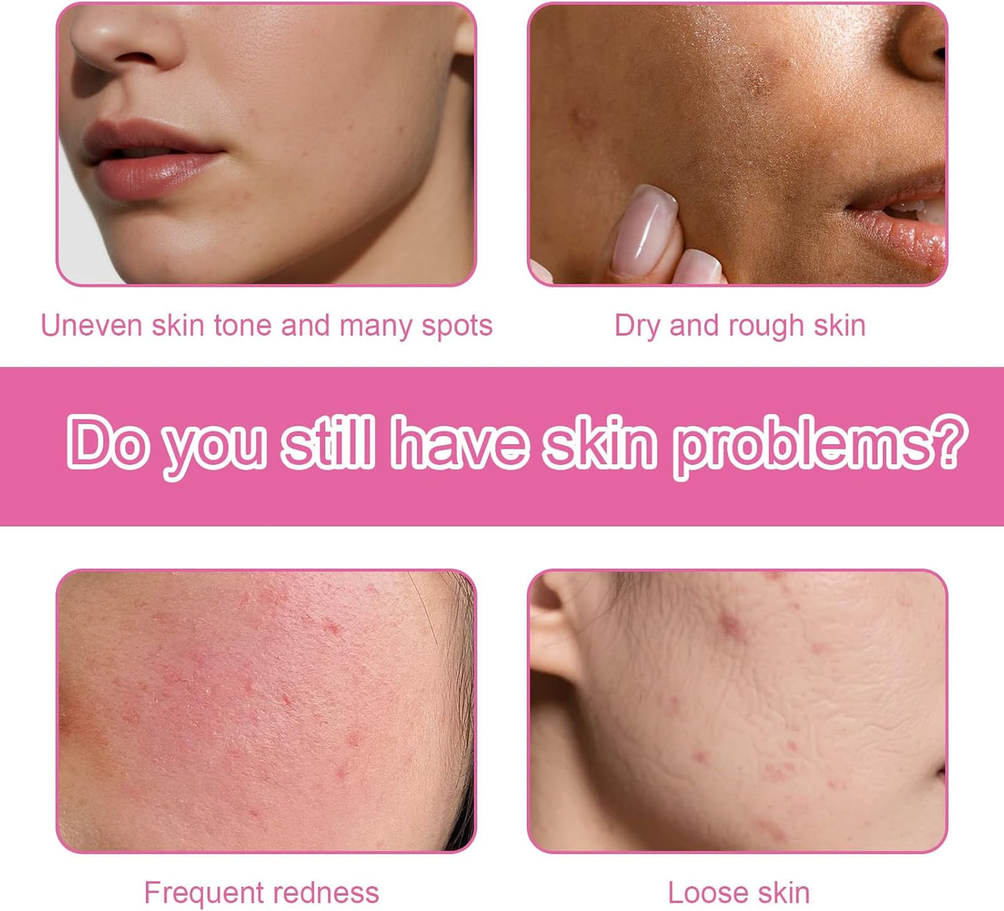 4 Pcs Arbutin 7% + Tranexamic Acid 4% Cream, Dark Spot Remover Hydrating Arbutin Cream, Helps Even Out Skin Tone for A Radiant Look, 4 * 30g