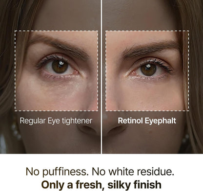 Dr.Melaxin Retinol Eyebag Cream For Puffiness, Wrinkle, Eye Moisturizer With Niacinamide & Ceramide Makeup Friendly Korean Skin Care 0.35 fl oz (Pack of 1)