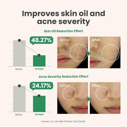 AXIS-Y Spot The Difference Blemish Treatment with AHA BHA Exfoliator for Blackhead Remover & 2% Niacinamide for Skin Glow - Vegan Korean Skincare Acne Treatment - 15ml/0.50 fl. oz.