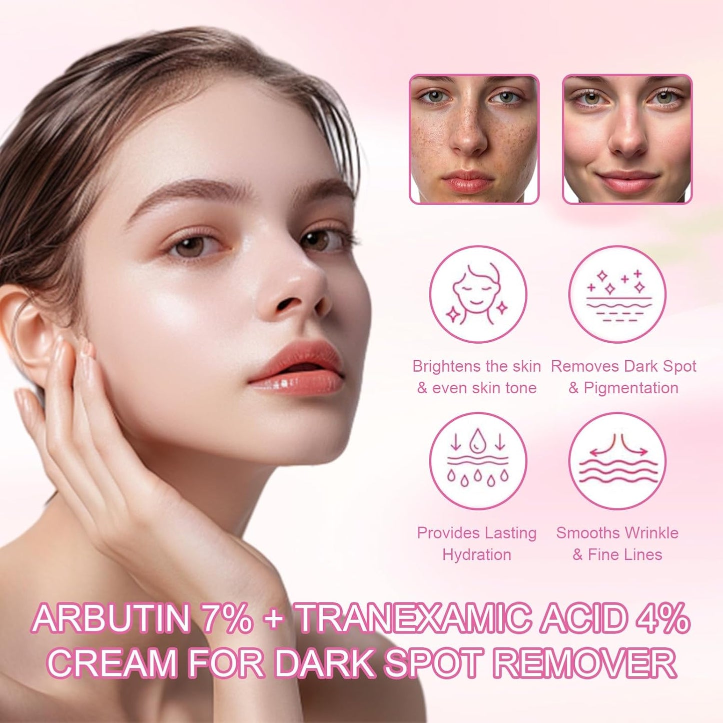 4 Pcs Arbutin 7% + Tranexamic Acid 4% Cream, Dark Spot Remover Hydrating Arbutin Cream, Helps Even Out Skin Tone for A Radiant Look, 4 * 30g