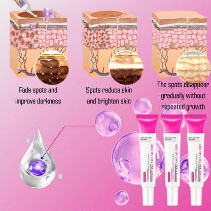 3PCS 7% Ar-butin + 4% Tranexamic Acid Cream，Dark Spot Corrector Face Cream for Women, Skin Brightening Korean Moisturiser, Anti Aging Hydrating Cream for Pigmentation, Reduces Redness，Even Skin Tone