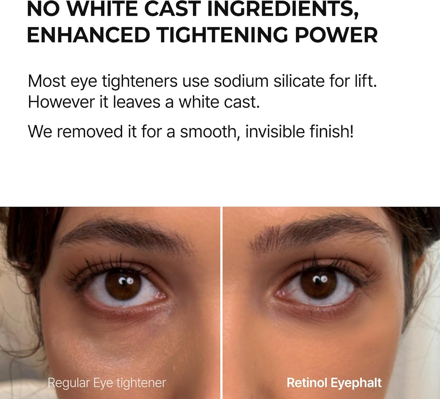 Dr.Melaxin Retinol Eyebag Cream For Puffiness, Wrinkle, Eye Moisturizer With Niacinamide & Ceramide Makeup Friendly Korean Skin Care 0.35 fl oz (Pack of 1)