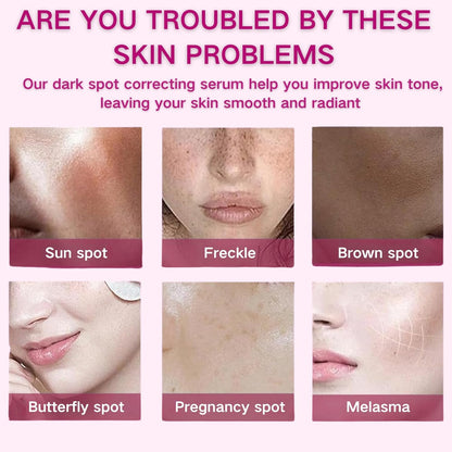 2PCS Arbutin 7% + Tranexamic Acid 4% Cream, Dark Spot Remover with Glutathione & Niacinamide, Hyperpigmentation, Skin Lightening Cream for Freckle, Blemishes, Pigmentation, Korean Skincare