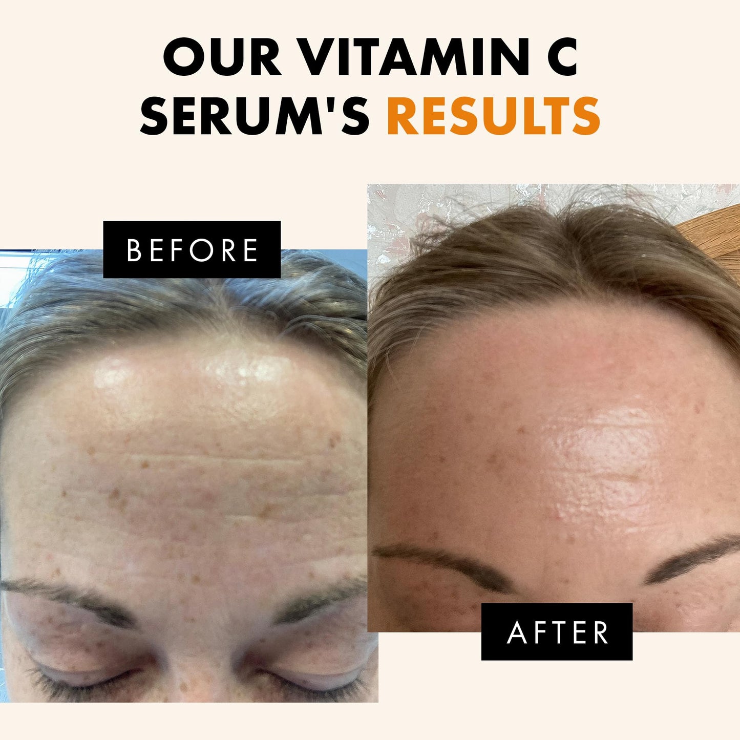 Eclat Skincare Glow Up Vitamin C Serum - Vitamin C Serum for Face with Hyaluronic Acid, Ferulic Acid & Vit E - Skin Brightening Face Care - Anti Aging, Hydrating & Dark Spot Lightening 30ml
