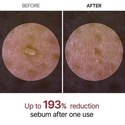 Dr.Melaxin Peel Shot Glow White Rice Peeling Ampoule, Soft Exfoliating Face and Body Scrub Dead Skin Cells Remover for All Skin Types korean skin care 80ml