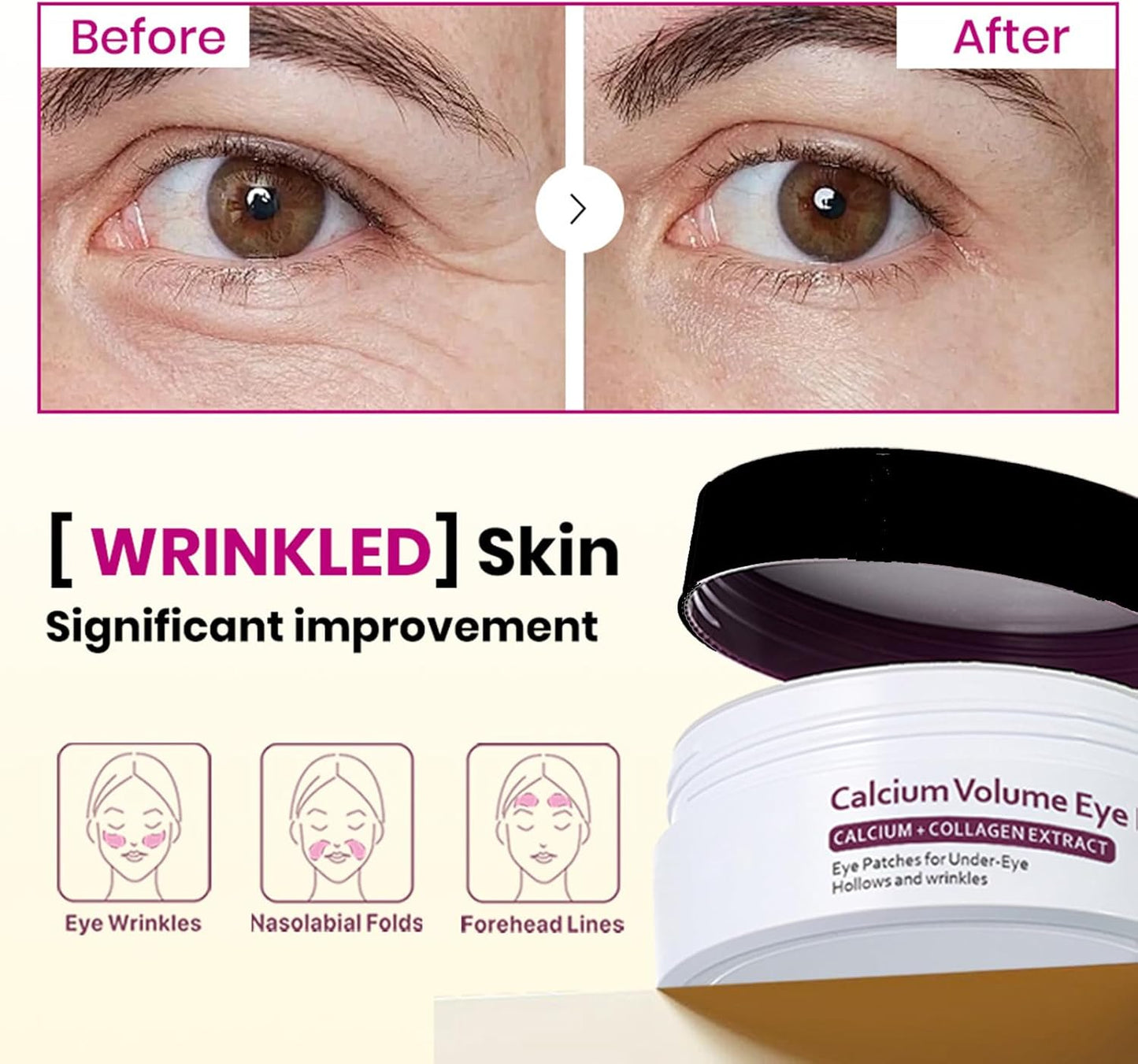 Calcium Multi Balm & Calcium Volume Eye Patches, Korean Advanced Calcium Volume Multi Balm, Under Eye Masks for Puffy Eyes, Reduce Puffiness & Hydrating, Firming Skin, Suitable for Eyes, Lips, Face