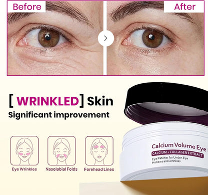 Calcium Multi Balm & Calcium Volume Eye Patches, Korean Advanced Calcium Volume Multi Balm, Under Eye Masks for Puffy Eyes, Reduce Puffiness & Hydrating, Firming Skin, Suitable for Eyes, Lips, Face