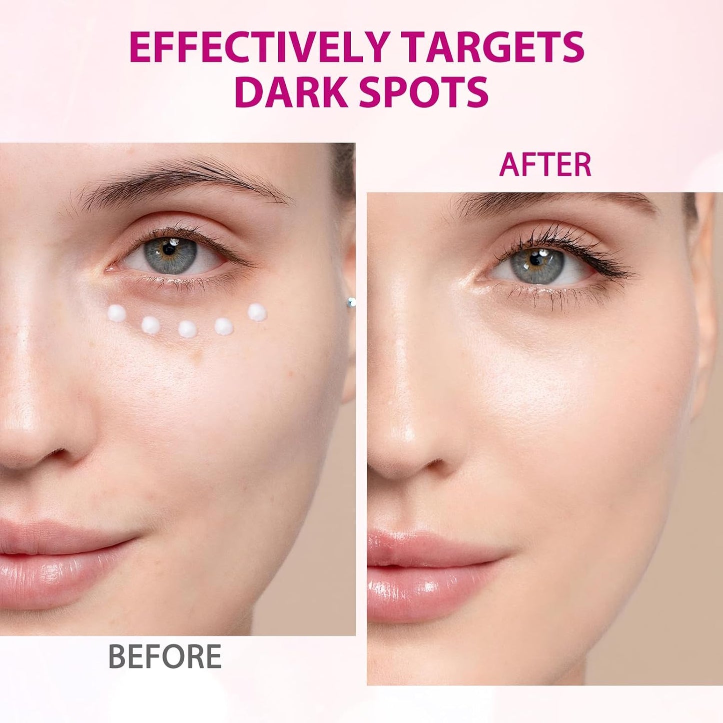 Arbutin 7% + Tranexamic Acid 4% Cream,Arbutin 7.0 Txa 4.0 Cream,Even Skin Tone, Fading Marks,Moisturiser, Gentle Skincare (50 ml)