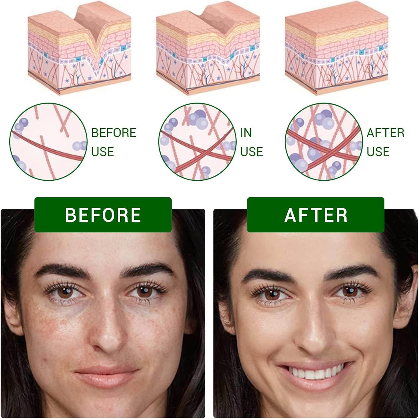 Dark Spot Correcting Glow Serum, Dark Spot Remover for Face Pore Refining, Fades Acne Marks Pits