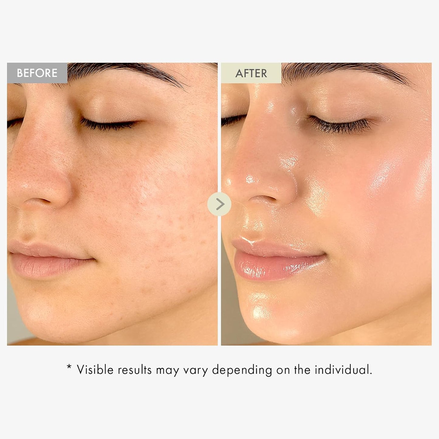 TOSOWOONG Real Collagen Face Serum – Hydrating & Firming Serum with Hydrolyzed Collagen, Hyaluronic Acid, for Smooth & Plump Skin, Korean Skincare, 33 ml / 1.11 fl. oz