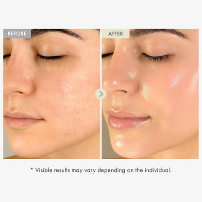 TOSOWOONG Real Collagen Face Serum – Hydrating & Firming Serum with Hydrolyzed Collagen, Hyaluronic Acid, for Smooth & Plump Skin, Korean Skincare, 33 ml / 1.11 fl. oz