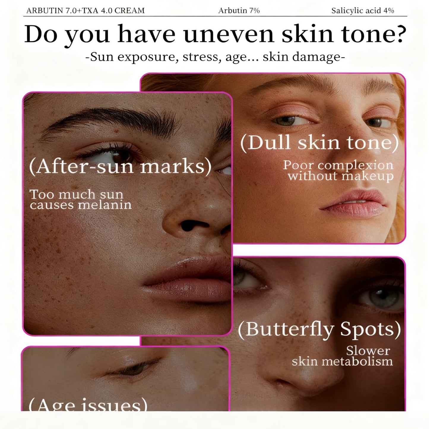 3PCS 7% Ar-butin + 4% Tranexamic Acid Cream，Dark Spot Corrector Face Cream for Women, Skin Brightening Korean Moisturiser, Anti Aging Hydrating Cream for Pigmentation, Reduces Redness，Even Skin Tone