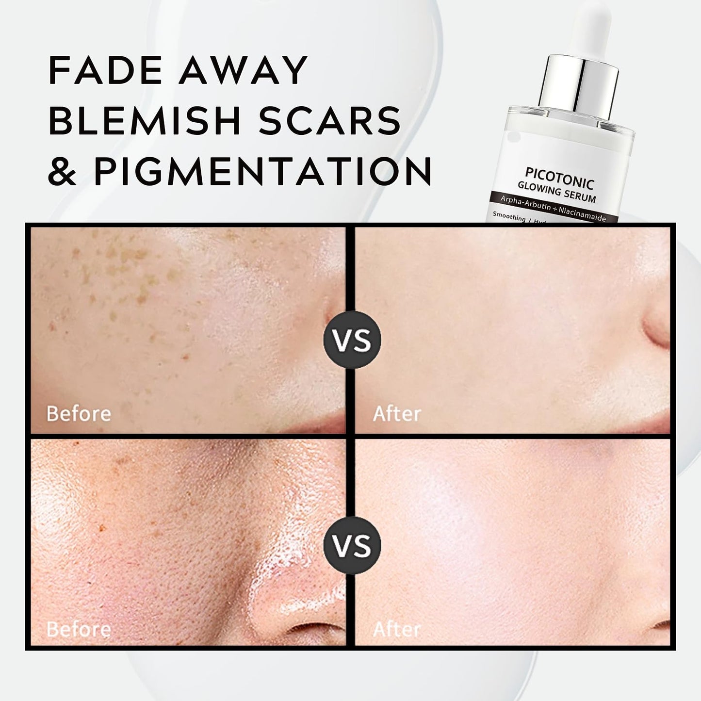 Pink Spicule Serum + Picotonic Shot Ampoule + Peel Shot Exfoliant Rice Ampoule, Rice Exfoliator for Face Pore Refining, Picotonic Glow Serum for Pigmentation & Dark Spot, Glass Skin, 3PCS