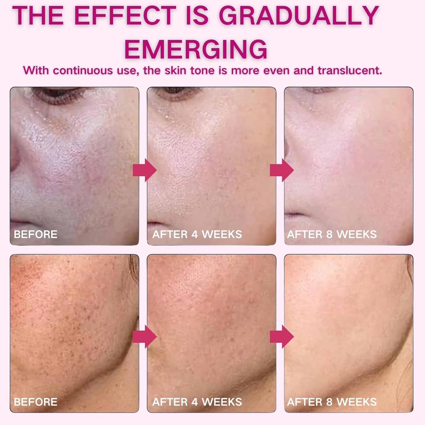 2PCS Arbutin 7% + Tranexamic Acid 4% Cream, Dark Spot Remover with Glutathione & Niacinamide, Hyperpigmentation, Skin Lightening Cream for Freckle, Blemishes, Pigmentation, Korean Skincare