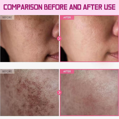 3PCS 7% Ar-butin + 4% Tranexamic Acid Cream，Dark Spot Corrector Face Cream for Women, Skin Brightening Korean Moisturiser, Anti Aging Hydrating Cream for Pigmentation, Reduces Redness，Even Skin Tone