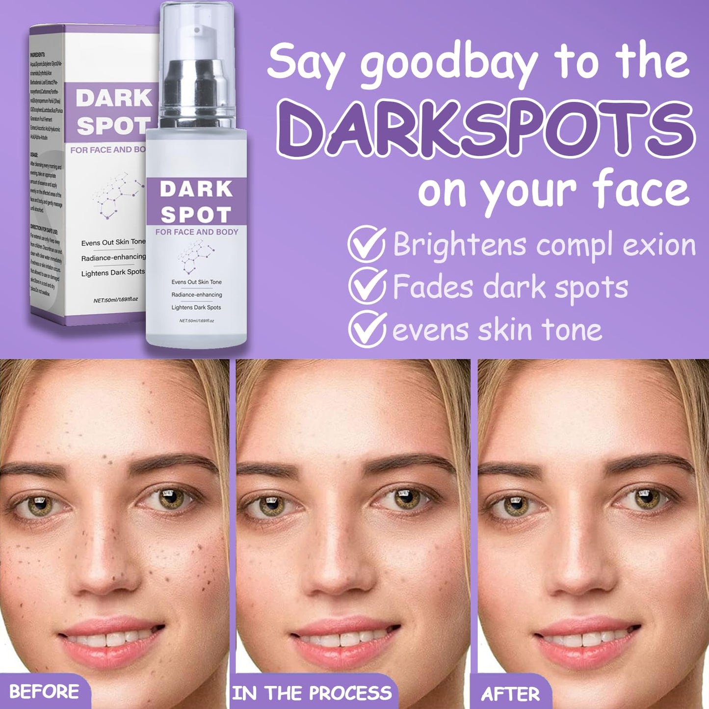 Dark Spot Remover for Face & Body, Dark Spot Corrector Cream, Age Spot Remover with Niacinamide & Hyaluronic Acid, Melasma Cream for Sun Spots & Hyperpigmentation, Brightening, Even Skin Tone, 50ml