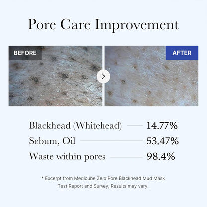 medicube Zero Pore Blackhead Mud Facial Mask - Skin Cooling & Pore Tightening - 3 Minute Quick Dry Formula with AHA, BHA, PHA, and Pore-Purifying Clay - Korean Mud Mask 100 g