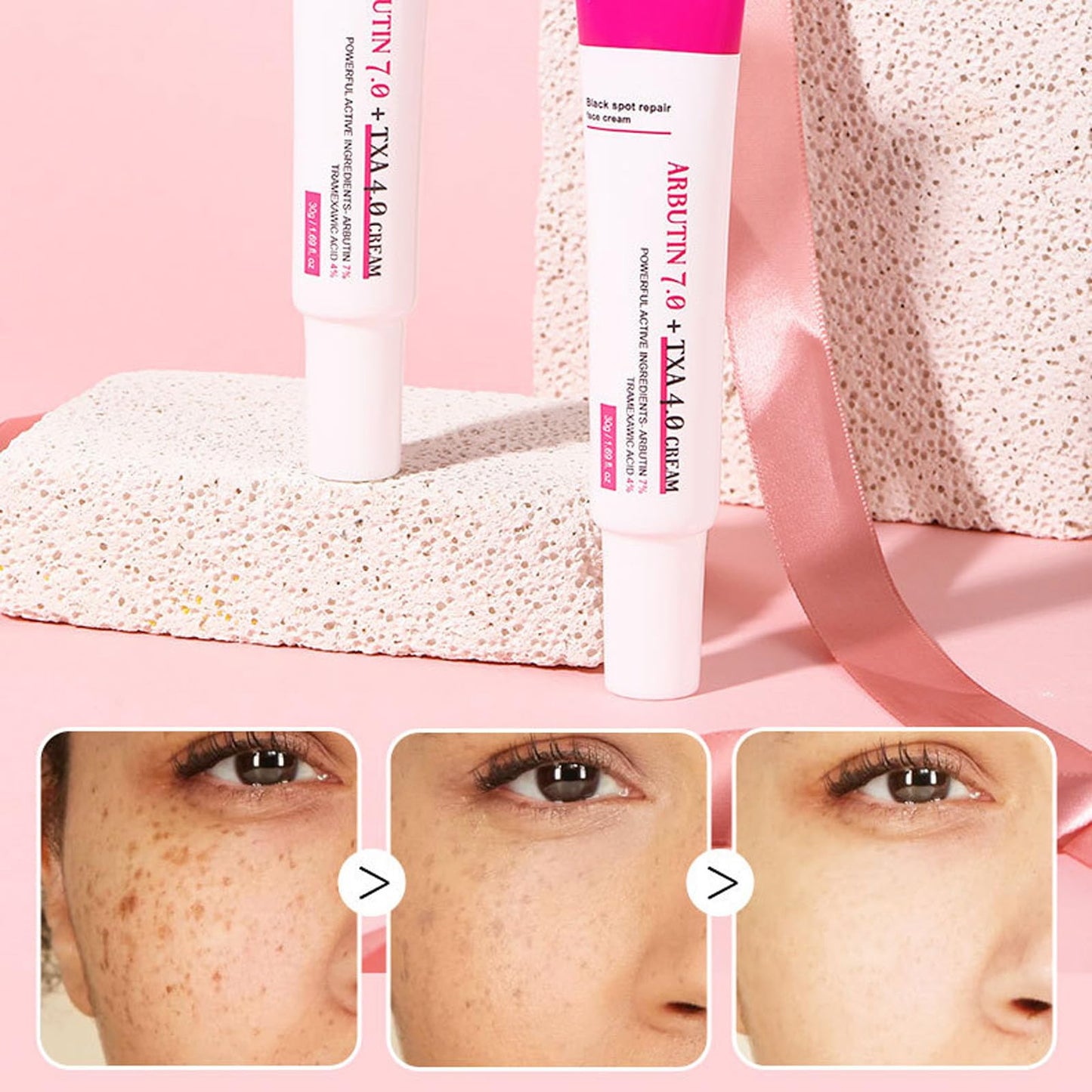 Arbutin 7% + Tranexamic Acid 4% Cream, Skin Brightening Anti Aging Hydrating, Dark Spot Corrector Face Cream for Women, Helps Even Out Skin Tone for A Radiant Look (1)