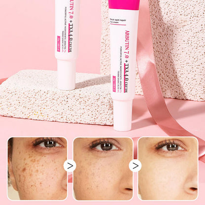 Arbutin 7% + Tranexamic Acid 4% Cream, Skin Brightening Anti Aging Hydrating, Dark Spot Corrector Face Cream for Women, Helps Even Out Skin Tone for A Radiant Look (1)